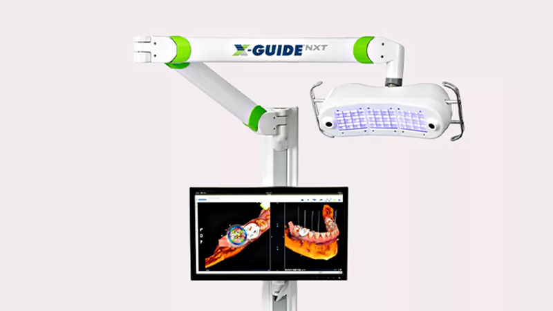精度を高める最新のナビゲーションシステム