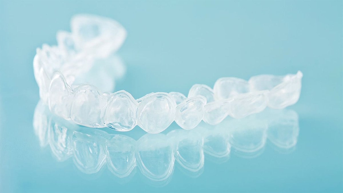 マウスピース矯正