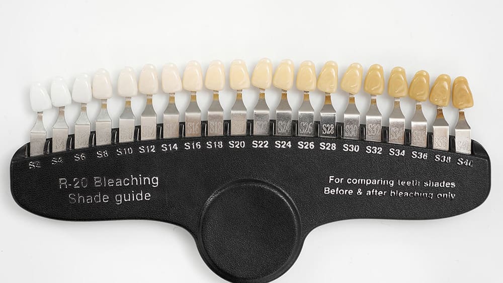 ホワイトニング