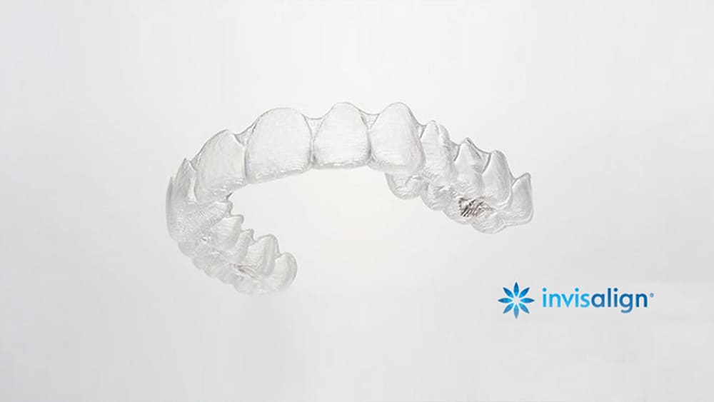 噛み合わせまで考慮したマウスピース矯正