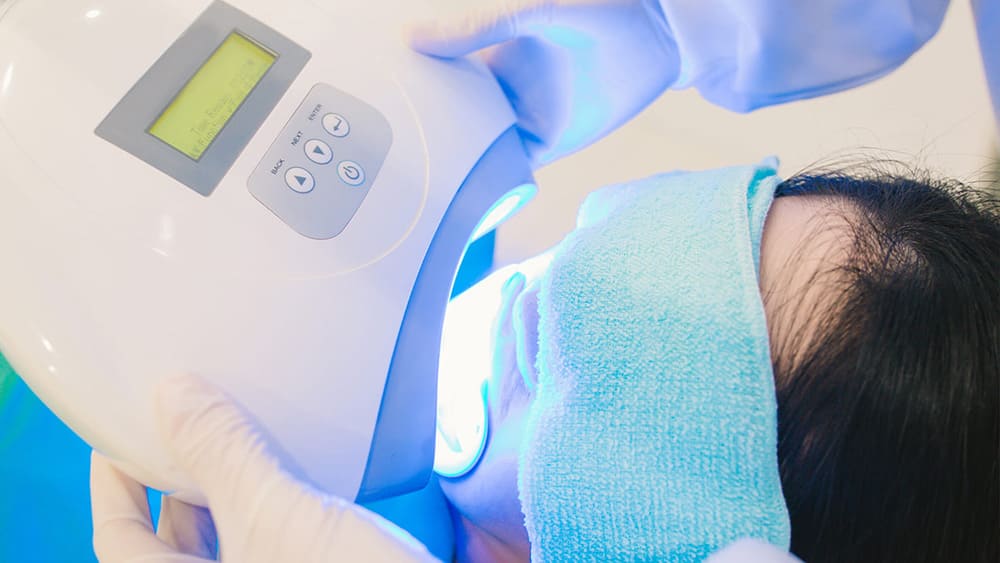 オフィスホワイトニング