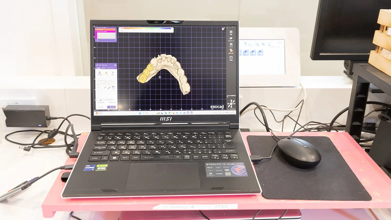 歯科用CAD/CAMソフトexocadで下顎の歯列3Dスキャンデータを表示するノートパソコンとマウス